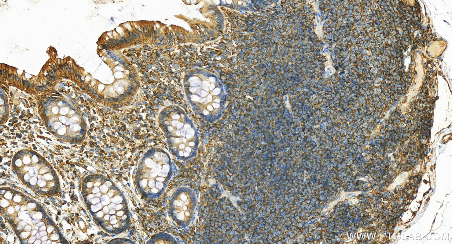 IHC staining of human normal colon using 15058-1-AP