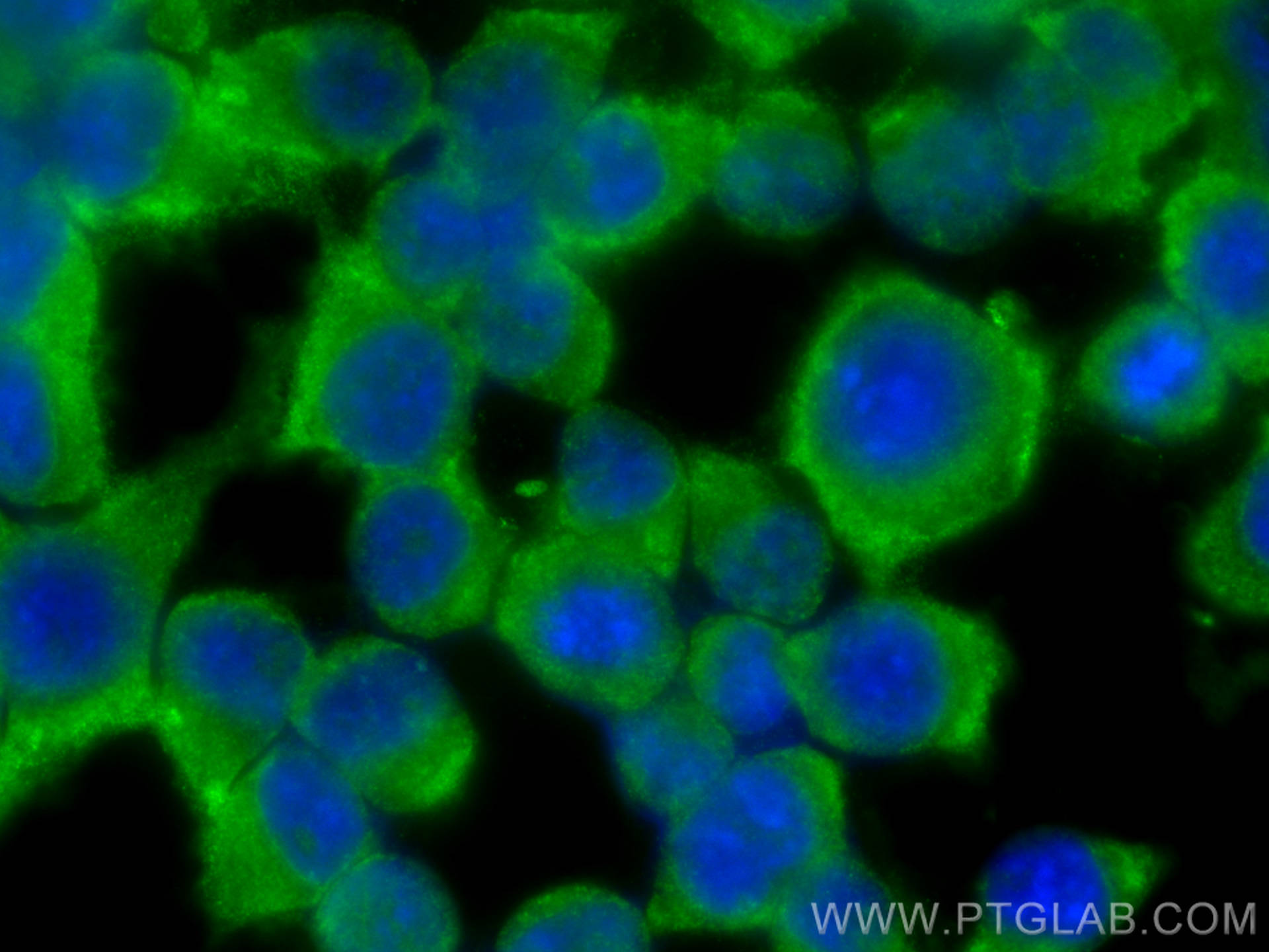 IF Staining of Neuro-2a using 16717-1-AP