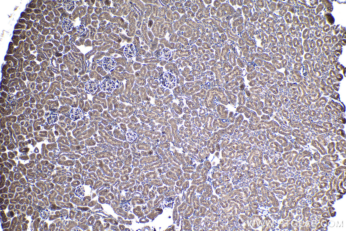 IHC staining of mouse kidney using 16717-1-AP