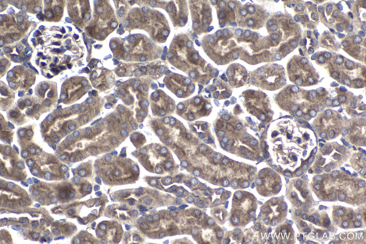 IHC staining of mouse kidney using 16717-1-AP