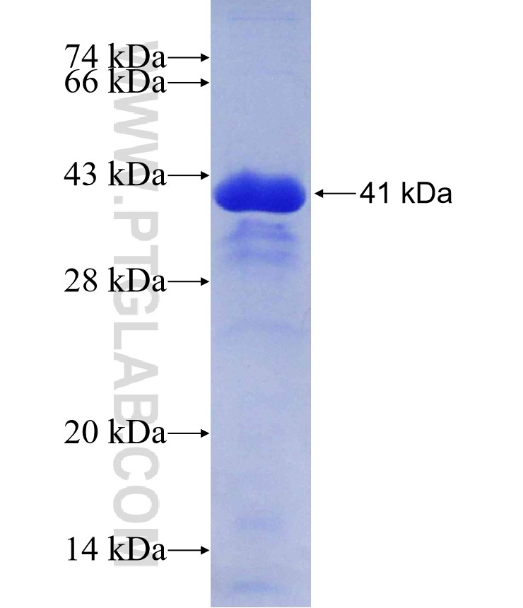 ARPP-19 fusion protein Ag2279 SDS-PAGE