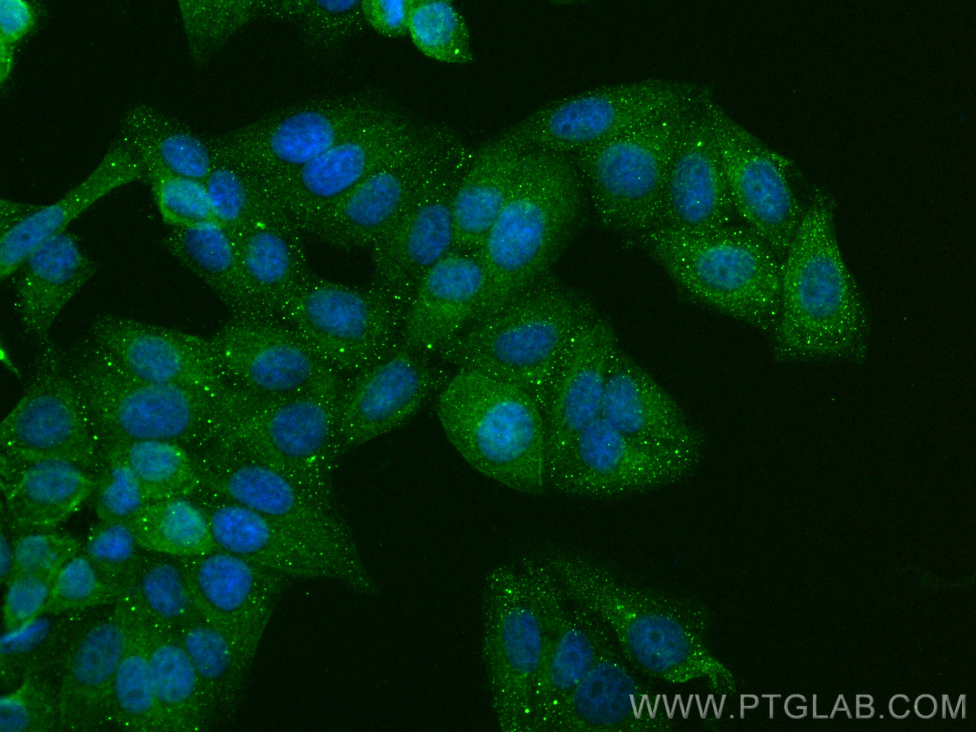 IF Staining of HepG2 using 31522-1-AP