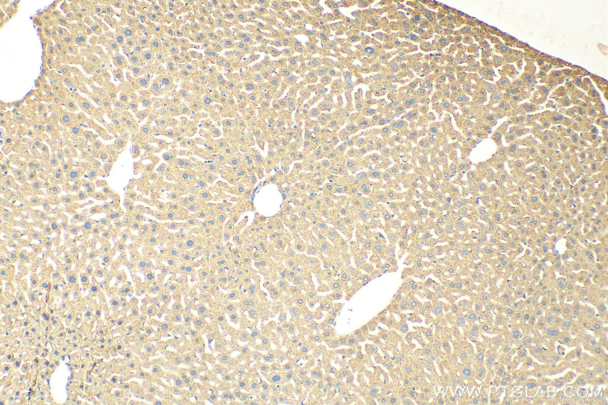 IHC staining of mouse liver using 31522-1-AP