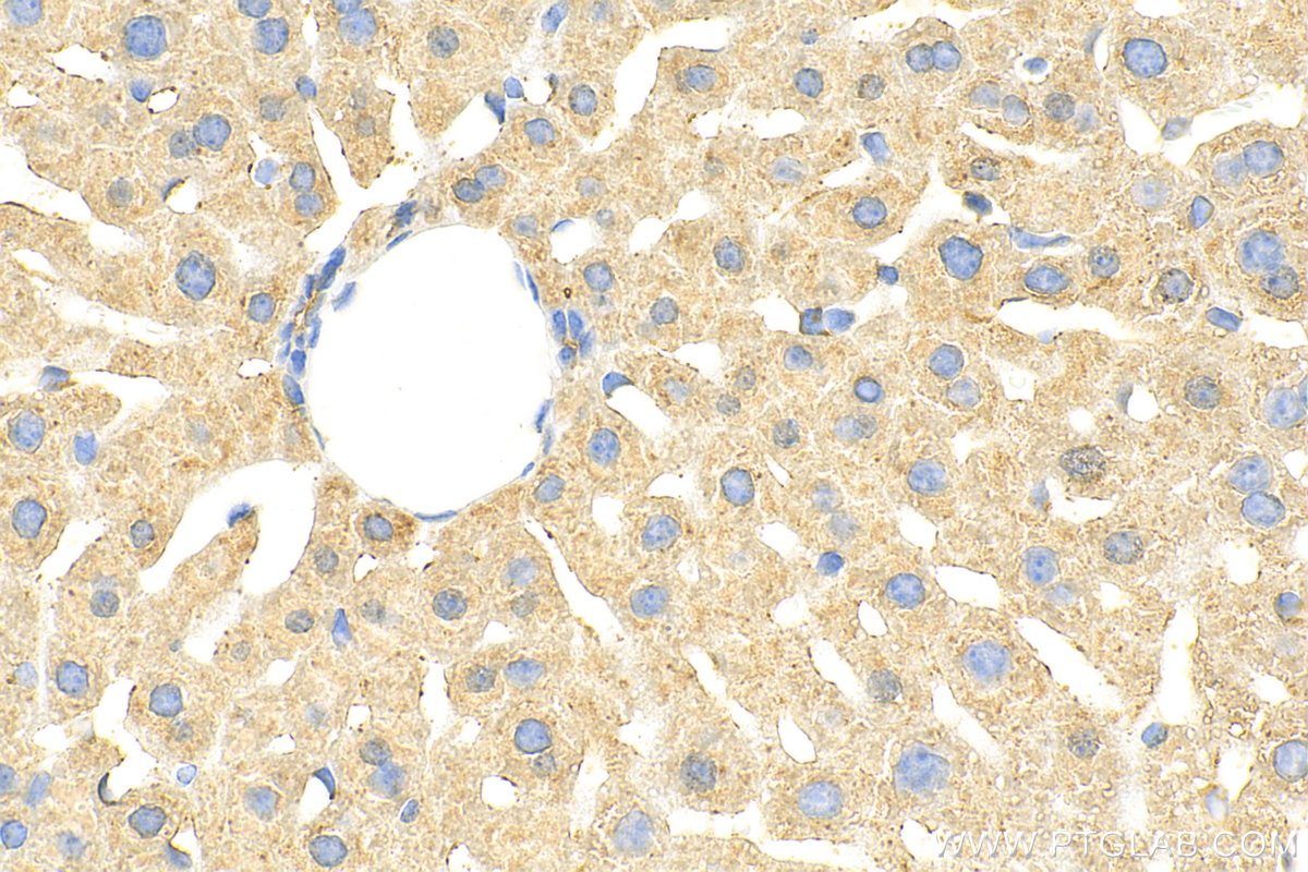 IHC staining of mouse liver using 31522-1-AP