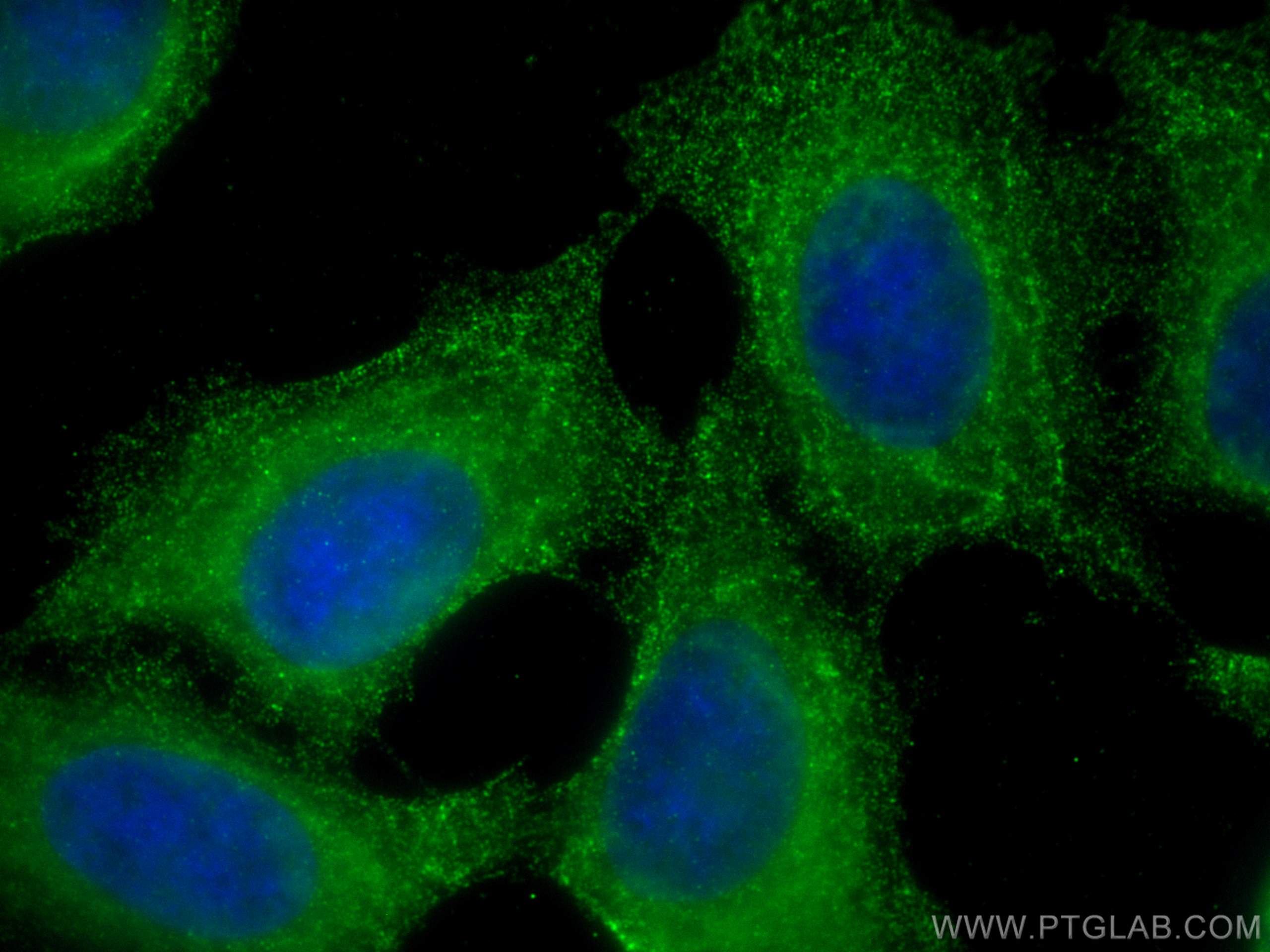 IF Staining of MCF-7 using 67092-2-Ig (same clone as 67092-2-PBS)