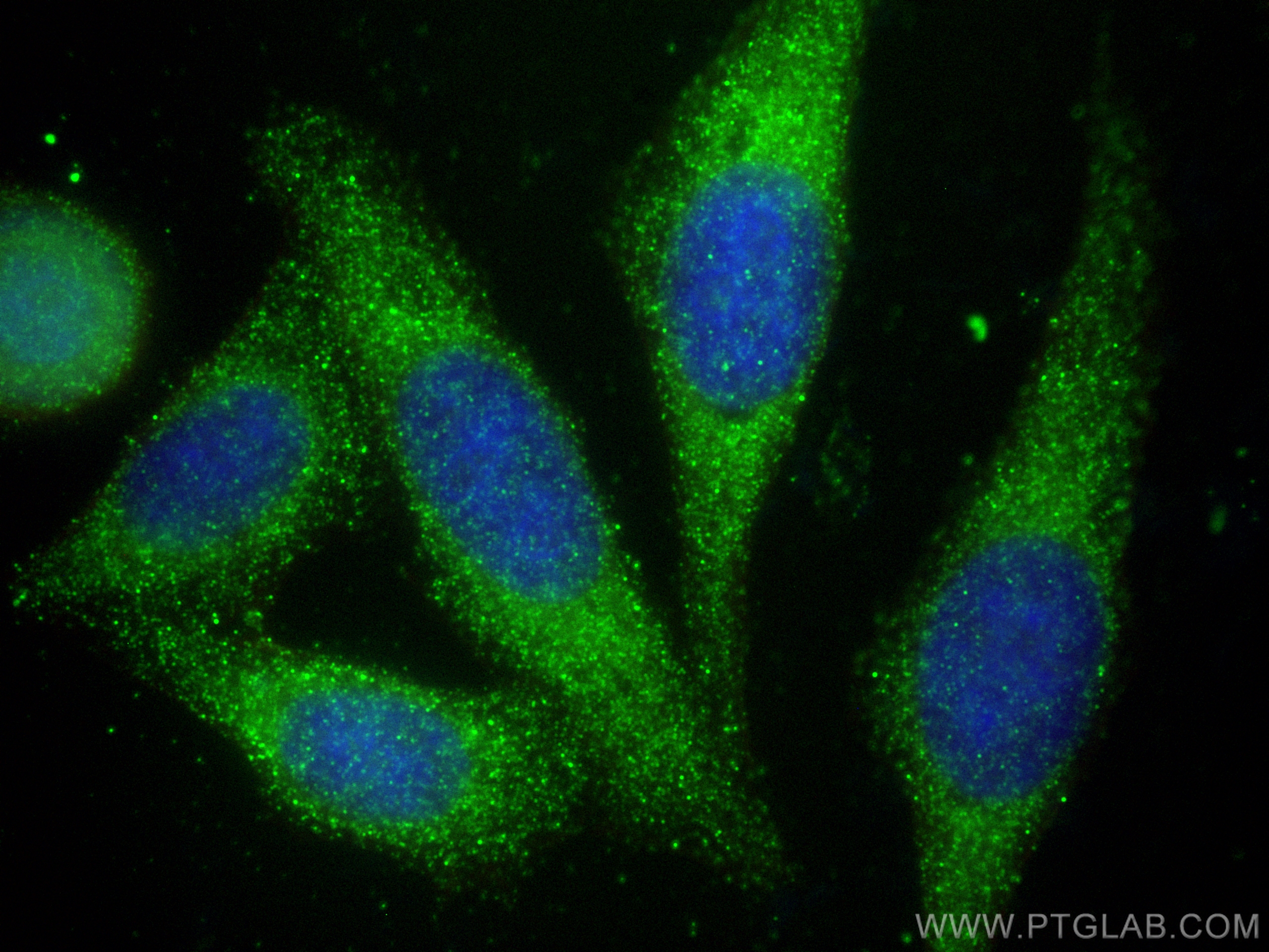 IF Staining of HepG2 using 25616-1-AP