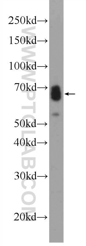 WB analysis of mouse spleen using 25300-1-AP