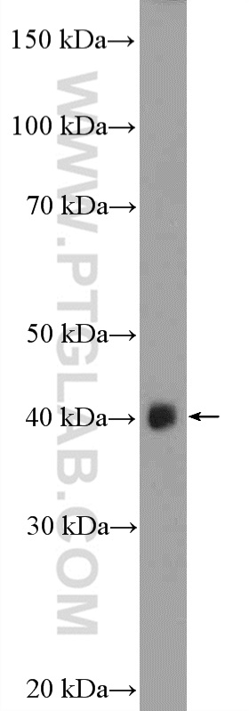 WB analysis of mouse skeletal muscle using 24031-1-AP