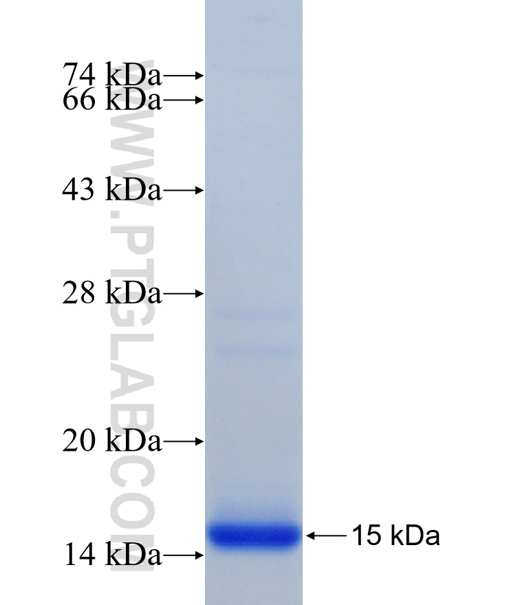 ASB5 fusion protein Ag21230 SDS-PAGE