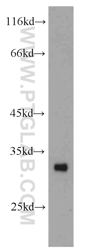 WB analysis of human heart using 11735-1-AP