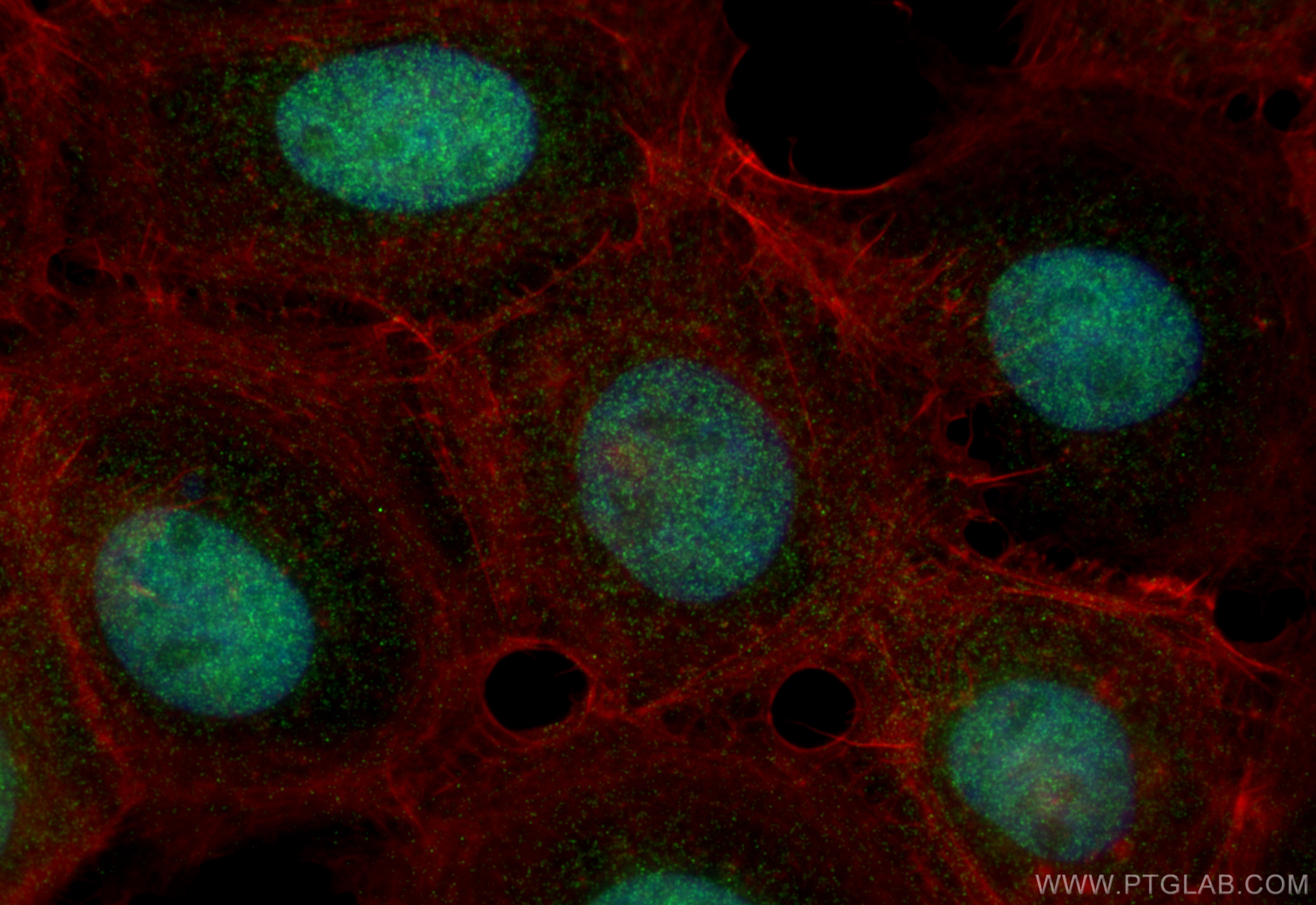 IF Staining of A431 using 22259-1-AP