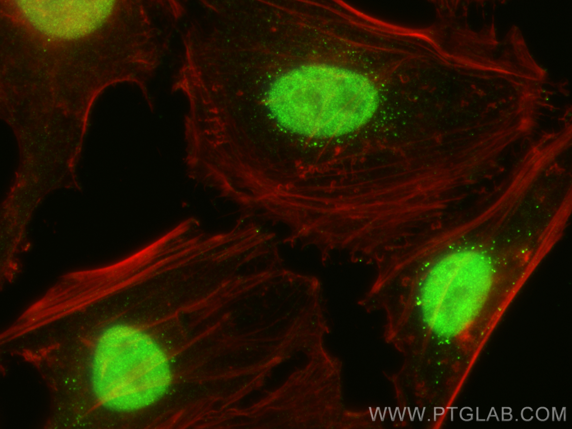 IF Staining of HeLa using 22258-1-AP