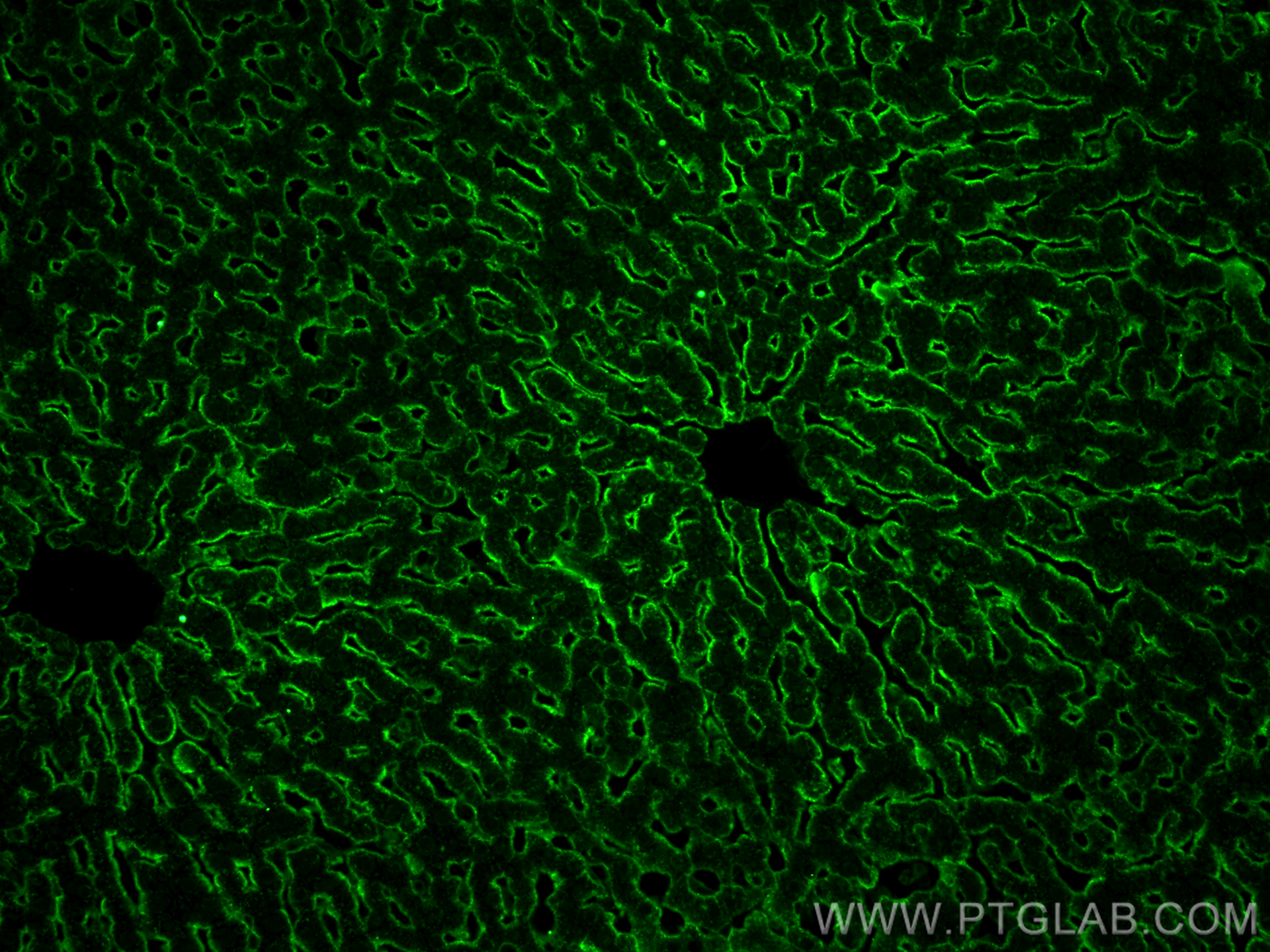 IF Staining of rat liver using 31338-1-AP