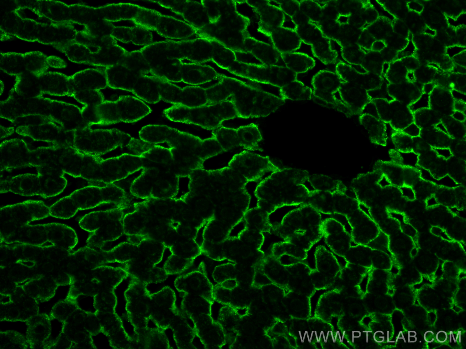 IF Staining of rat liver using 31338-1-AP