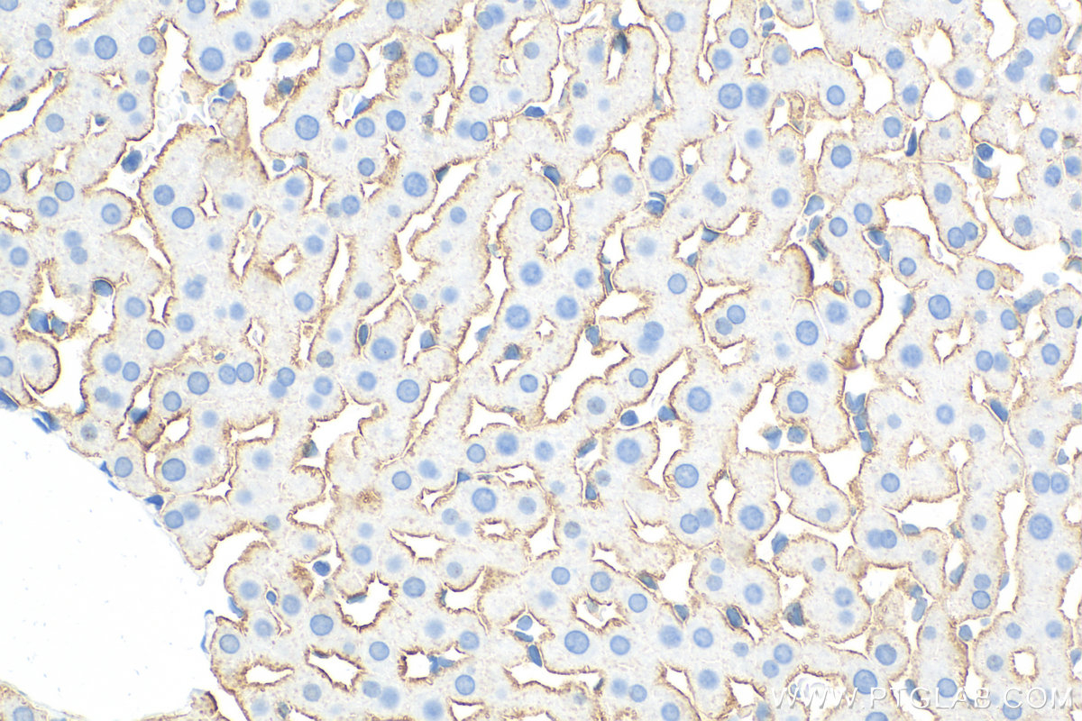 IHC staining of rat liver using 31338-1-AP