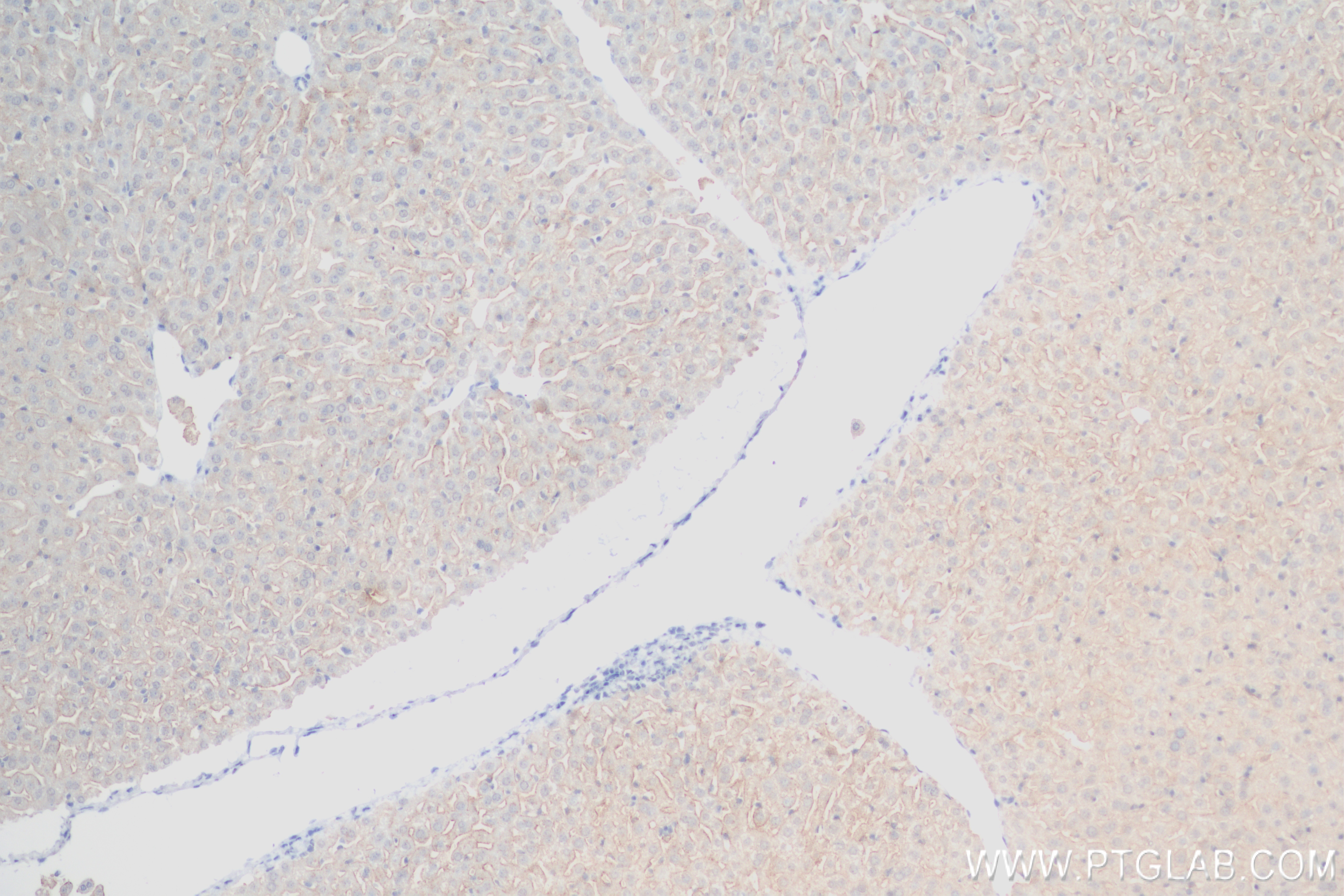 IHC staining of mouse liver using 83691-3-RR