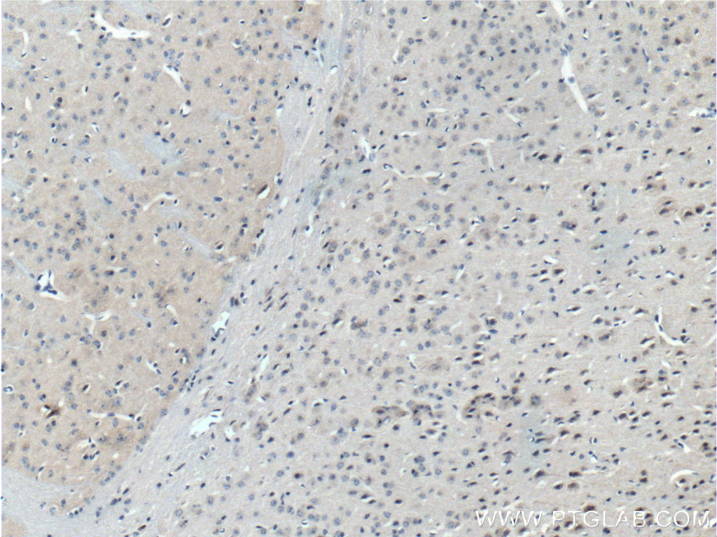 ASIC1 antibody (27235-1-AP) | Proteintech | 武汉三鹰生物技术有限公司