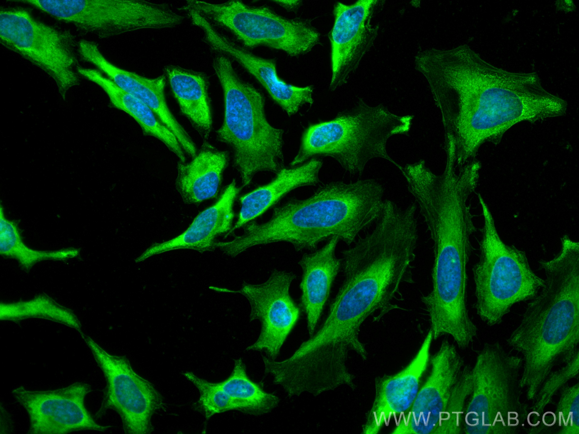 IF Staining of HeLa using CL488-66346