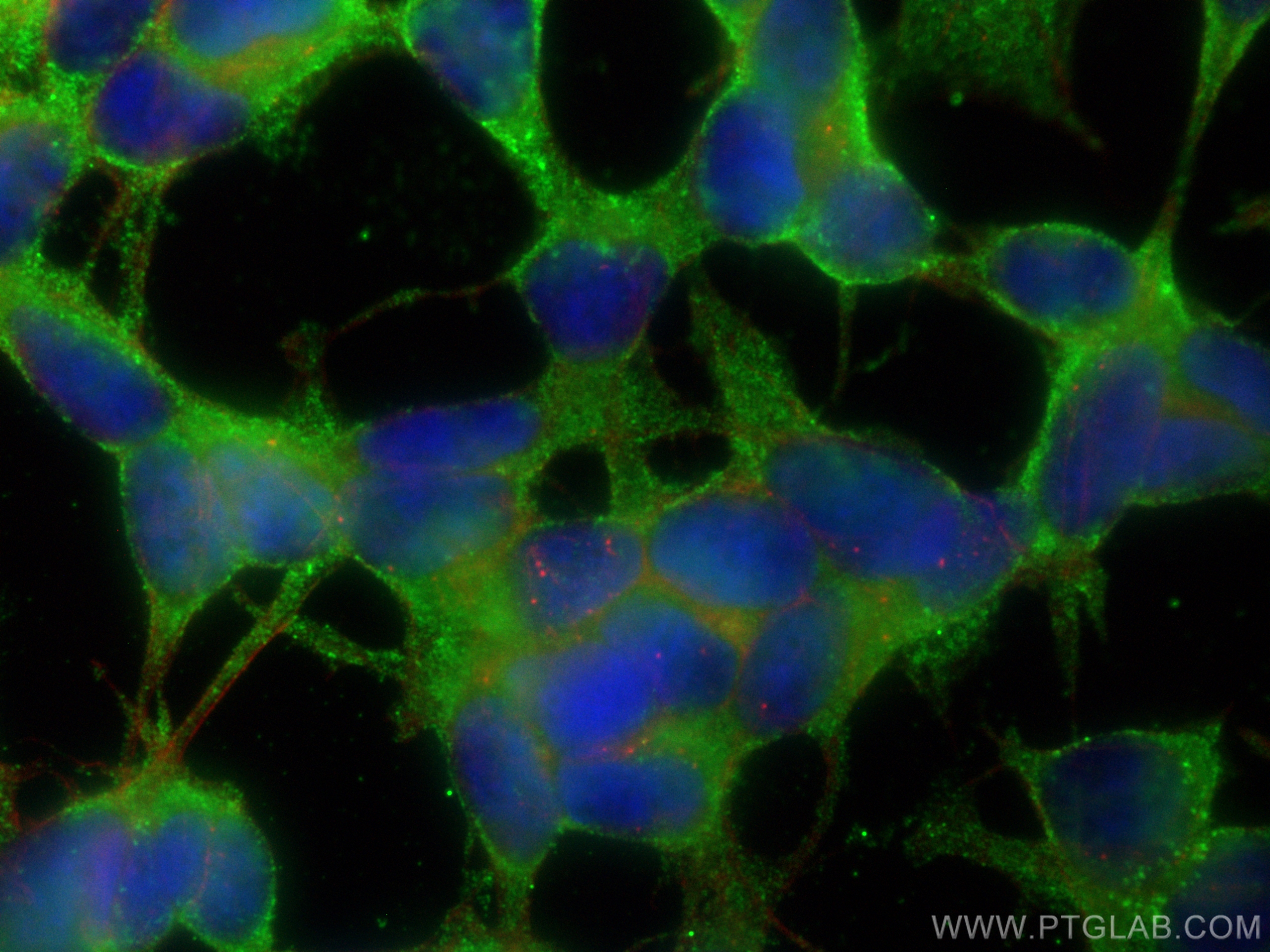 IF Staining of SH-SY5Y using 68004-1-Ig (same clone as 68004-1-PBS)