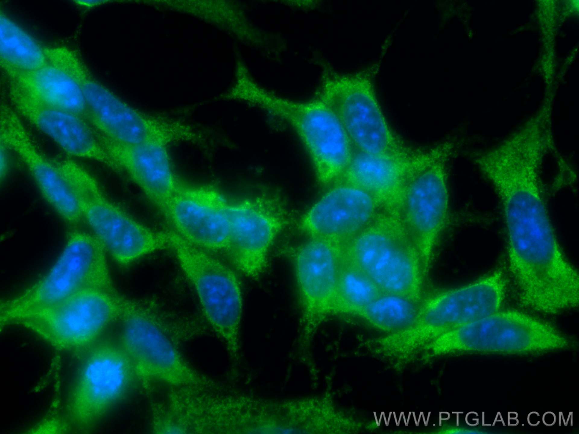 IF Staining of SH-SY5Y using CL488-68004