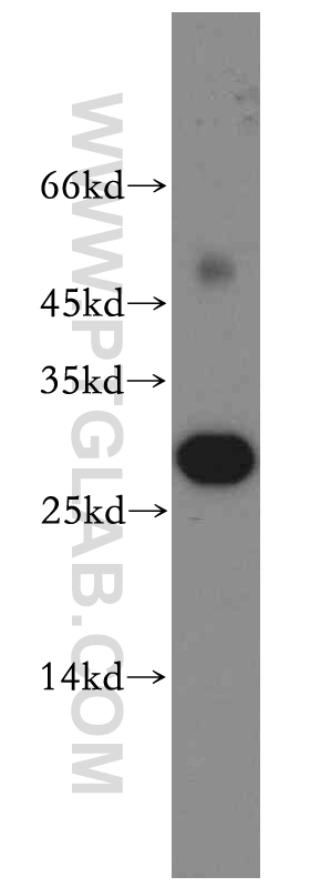 WB analysis of mouse skin using 13052-1-AP