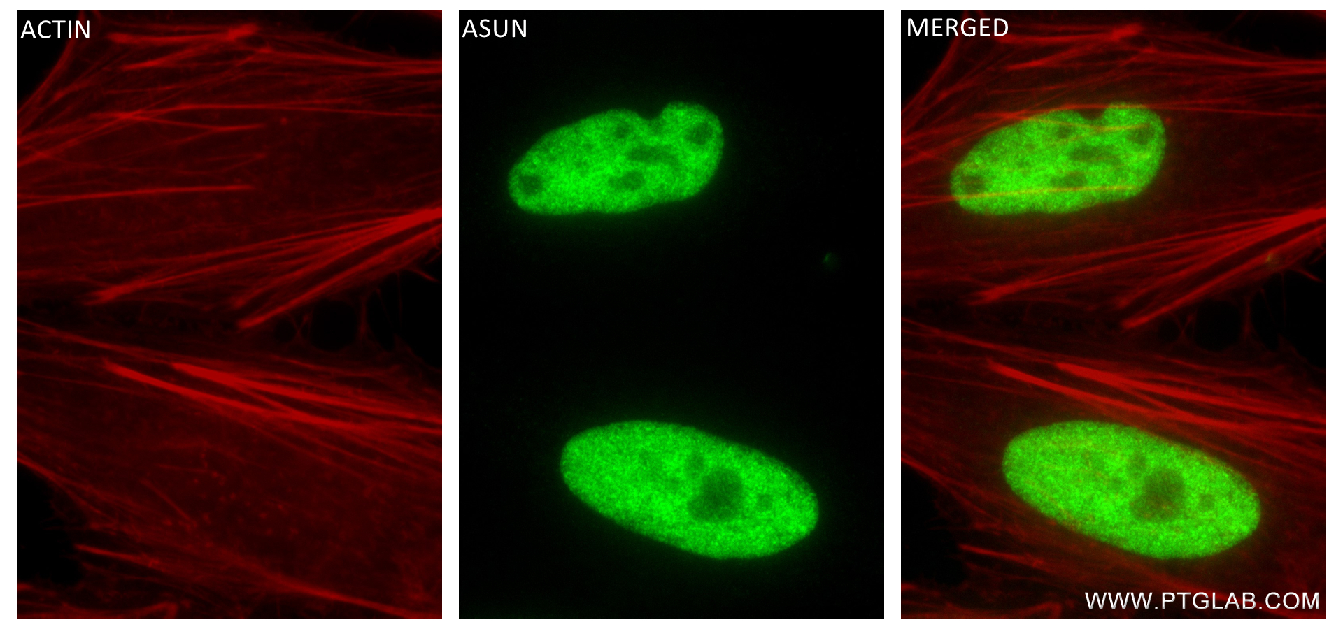 IF Staining of HeLa using 84252-4-RR