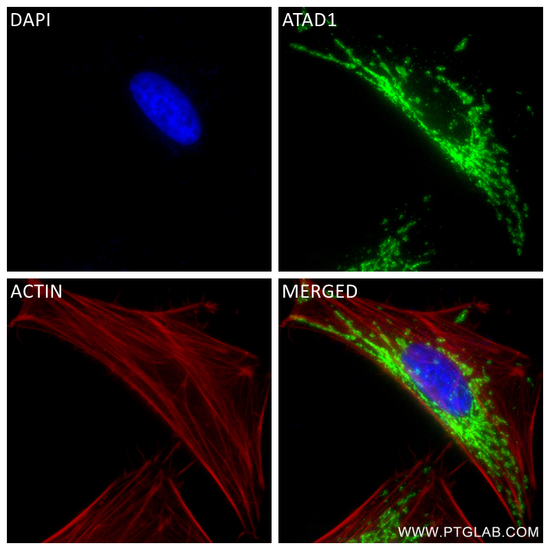 IF Staining of HeLa using 84194-6-RR