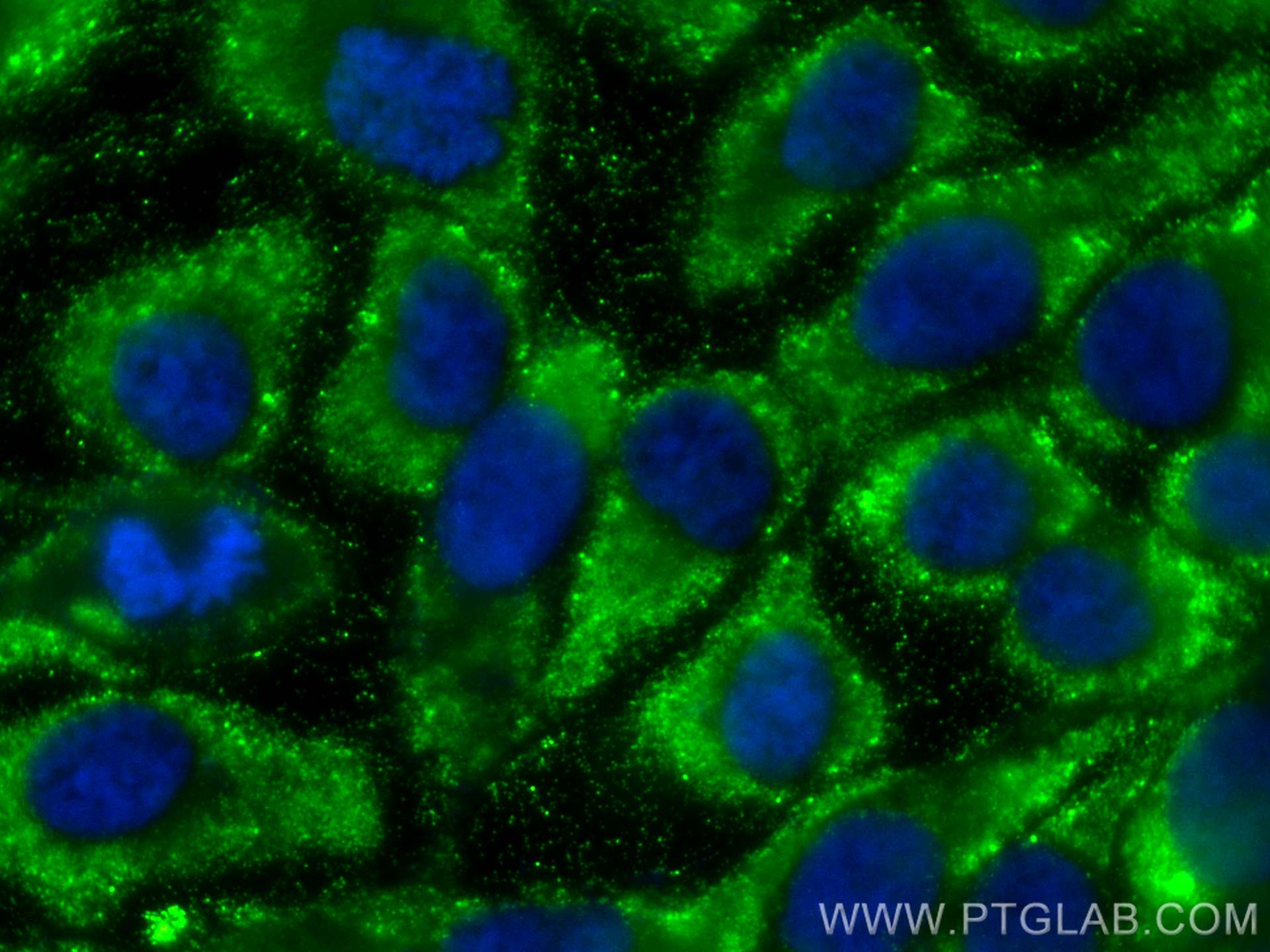 IF Staining of A431 using 25693-1-AP