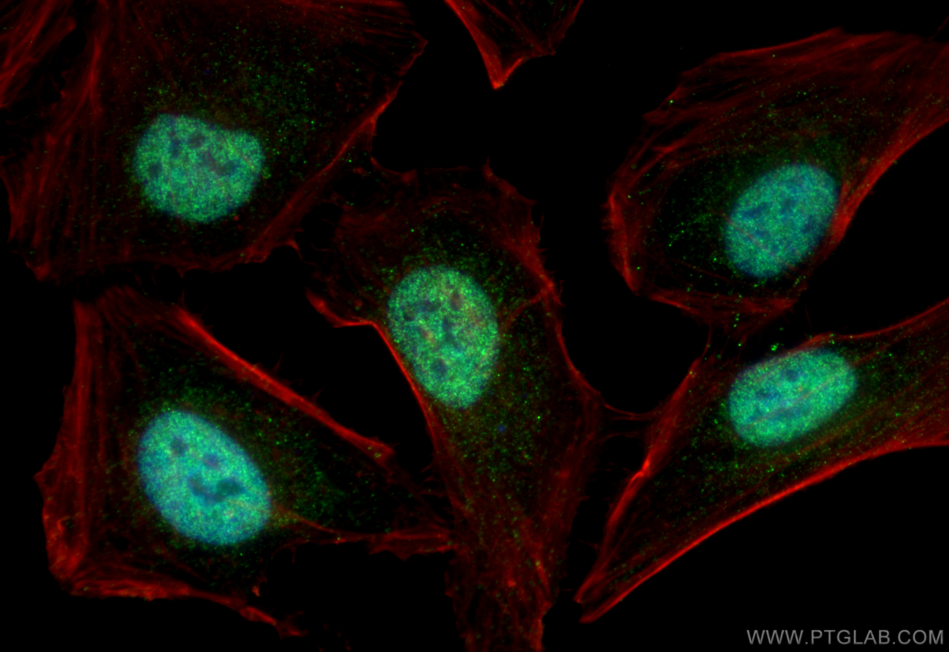 IF Staining of HeLa using 11908-1-AP