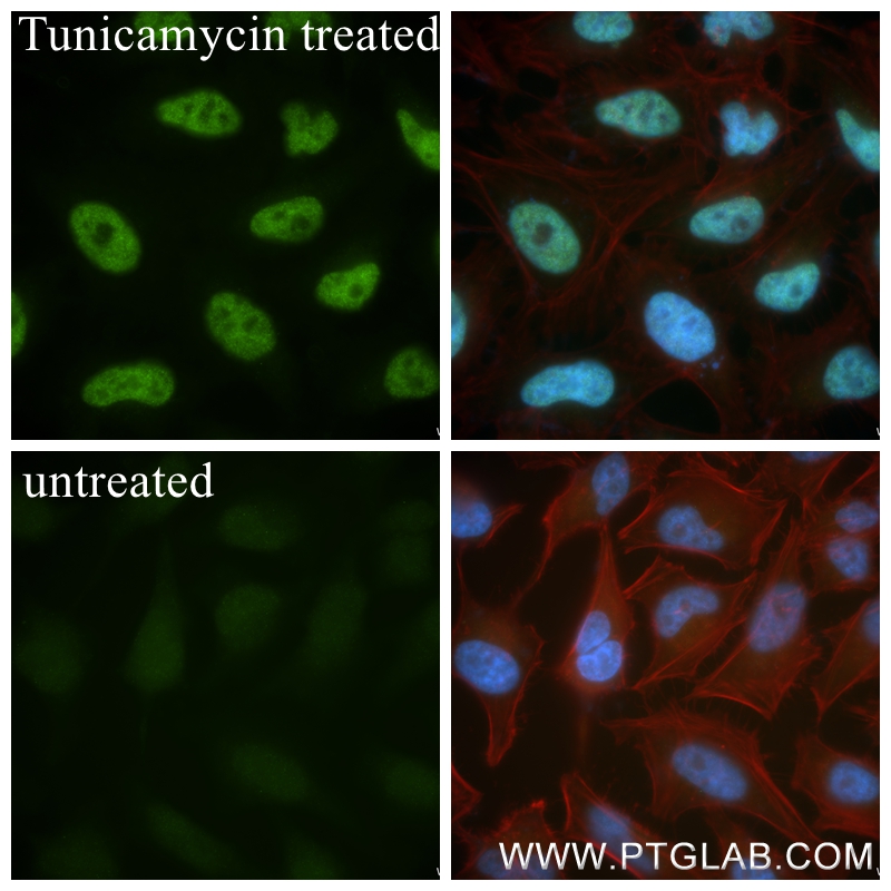 IF Staining of HeLa using 81798-2-RR