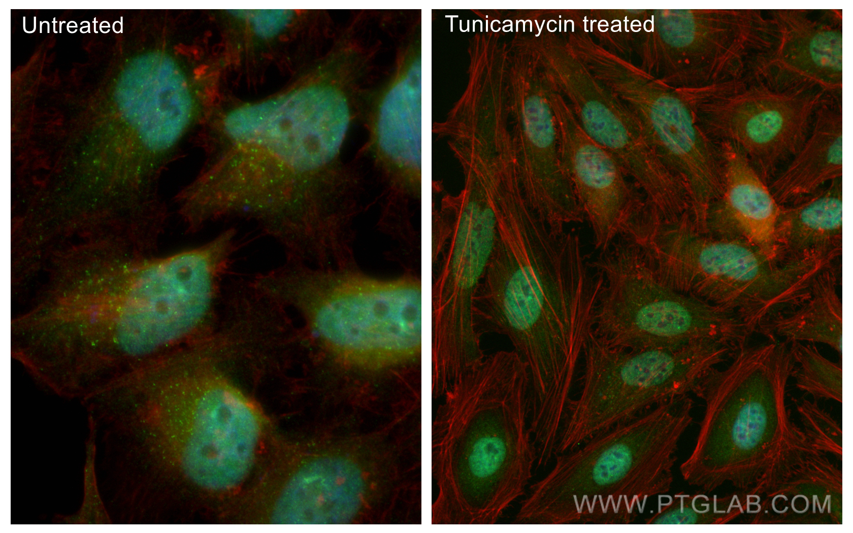 IF Staining of HeLa using CL488-81798-2