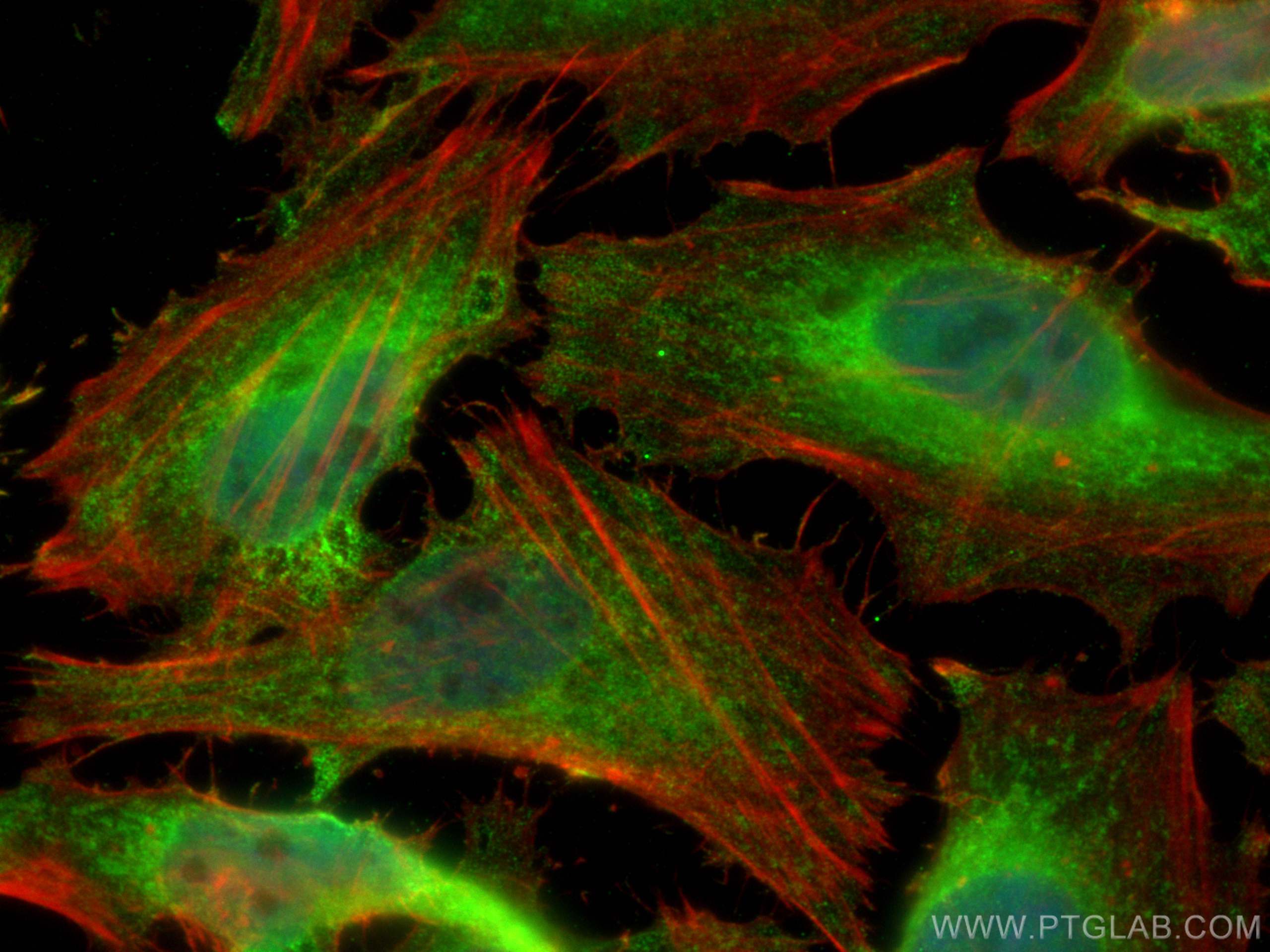 IF Staining of HeLa using 24169-1-AP