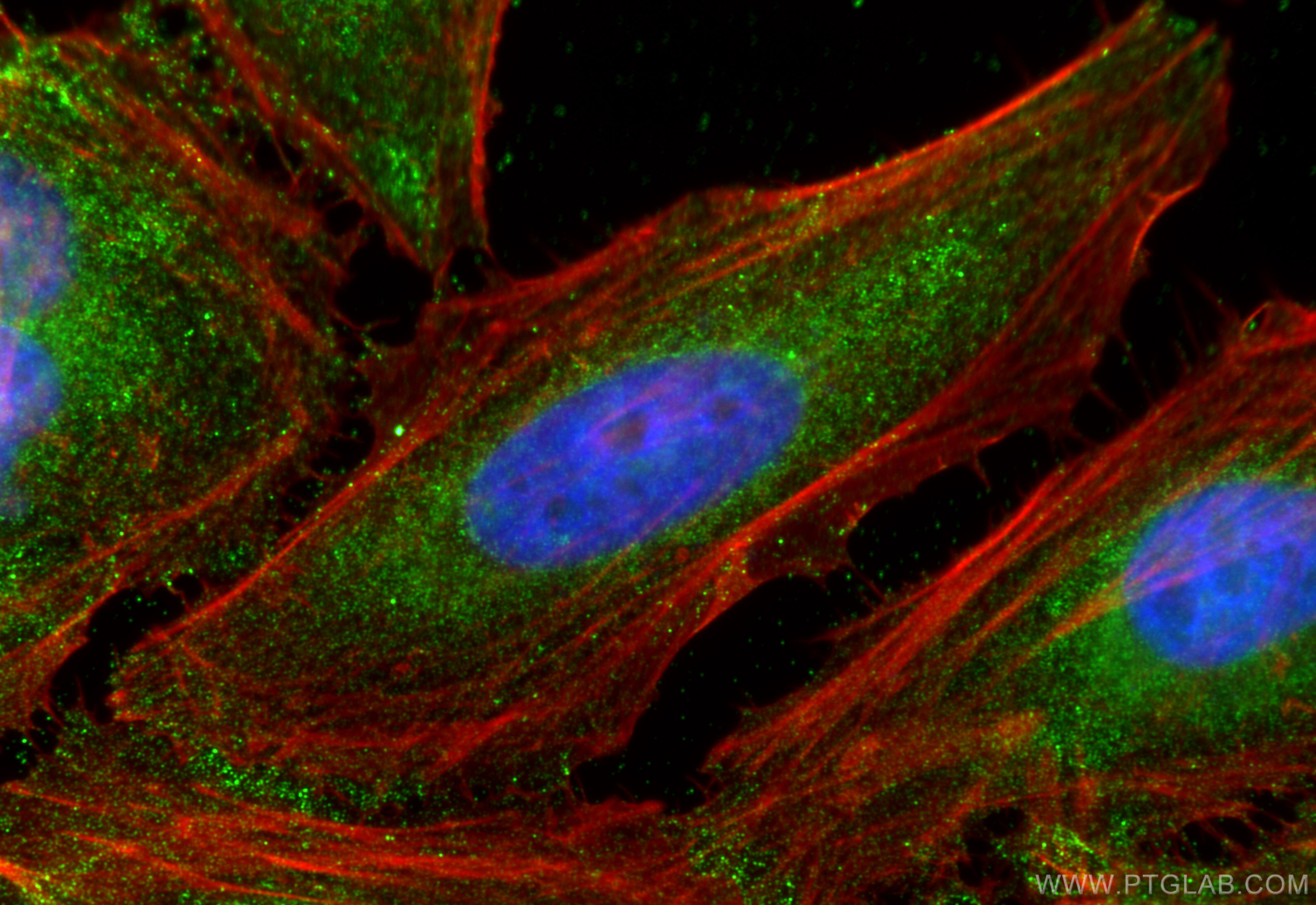 IF Staining of HeLa using 66563-1-Ig