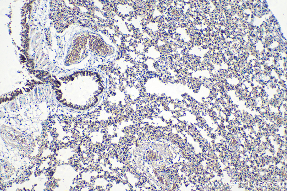 IHC staining of mouse lung using 29770-1-AP (same clone as 29770-1-PBS)