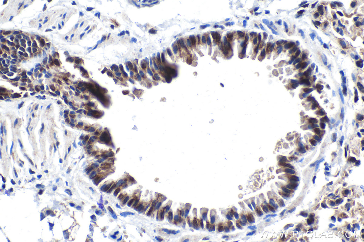 IHC staining of mouse lung using 29770-1-AP