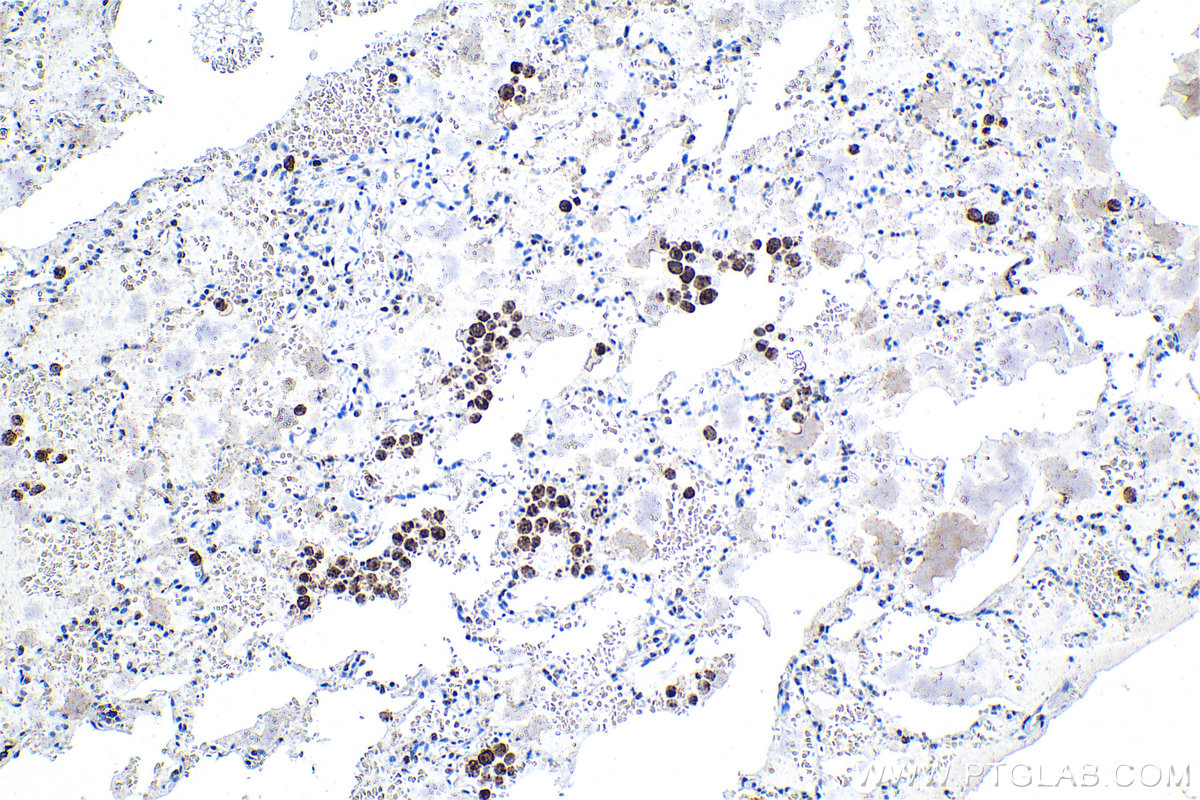 IHC staining of human lung using 29770-1-AP (same clone as 29770-1-PBS)