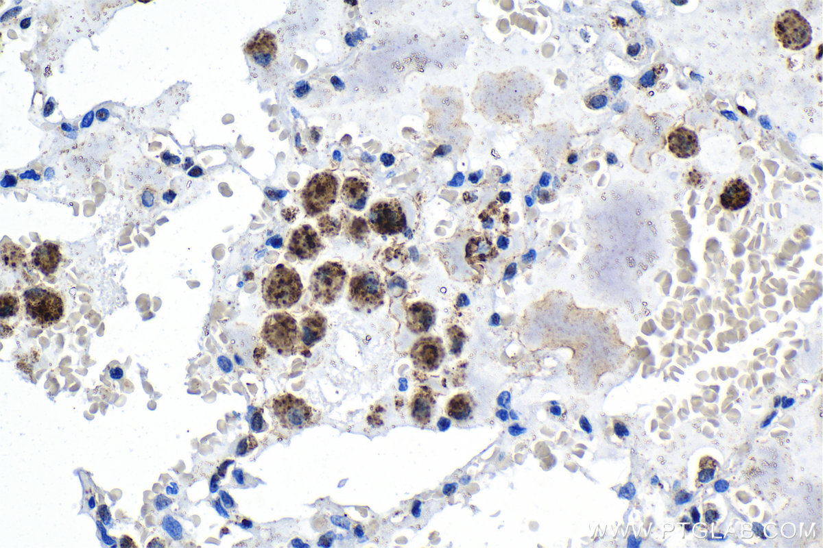 IHC staining of human lung using 29770-1-AP (same clone as 29770-1-PBS)