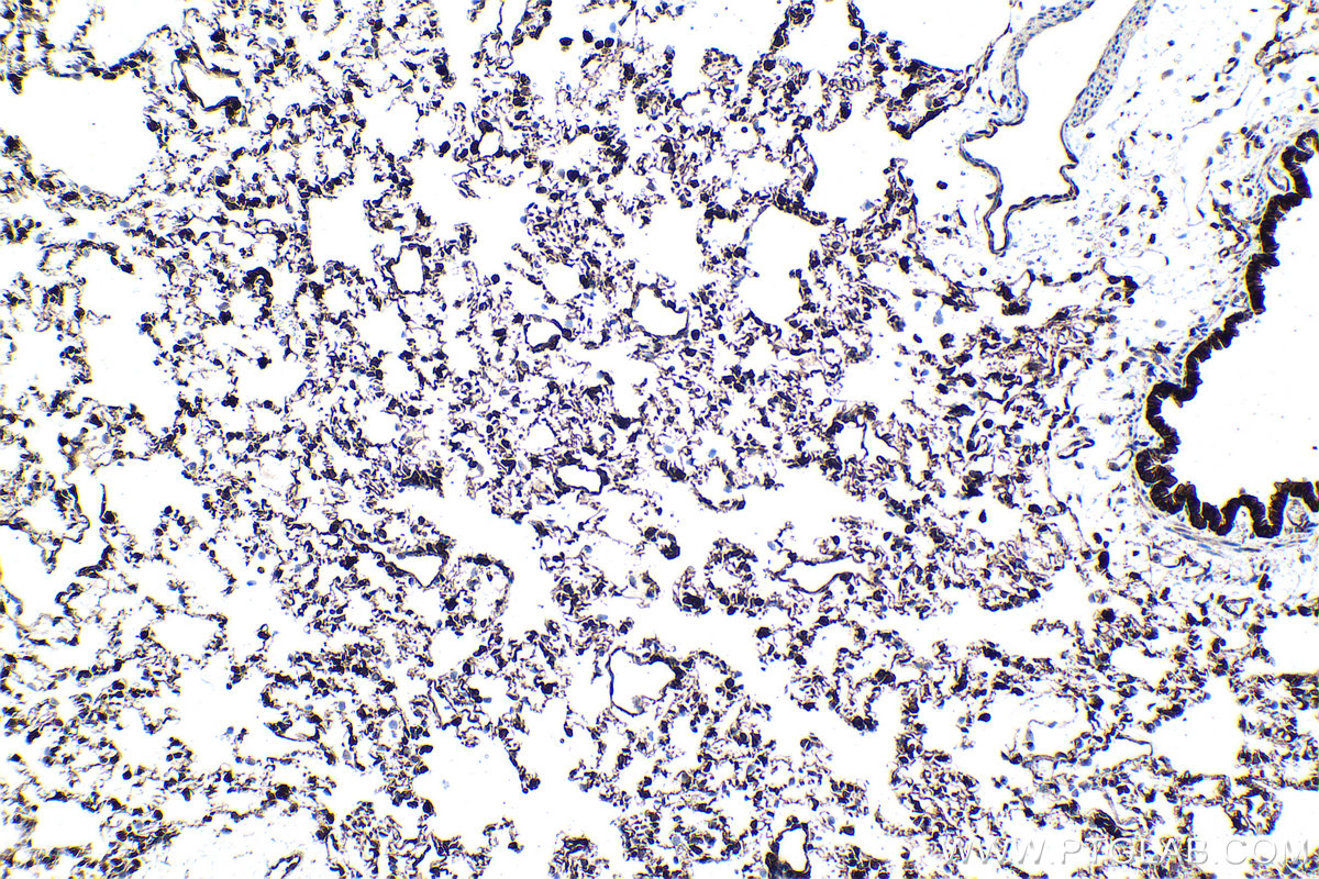 IHC staining of rat lung using 29770-1-AP