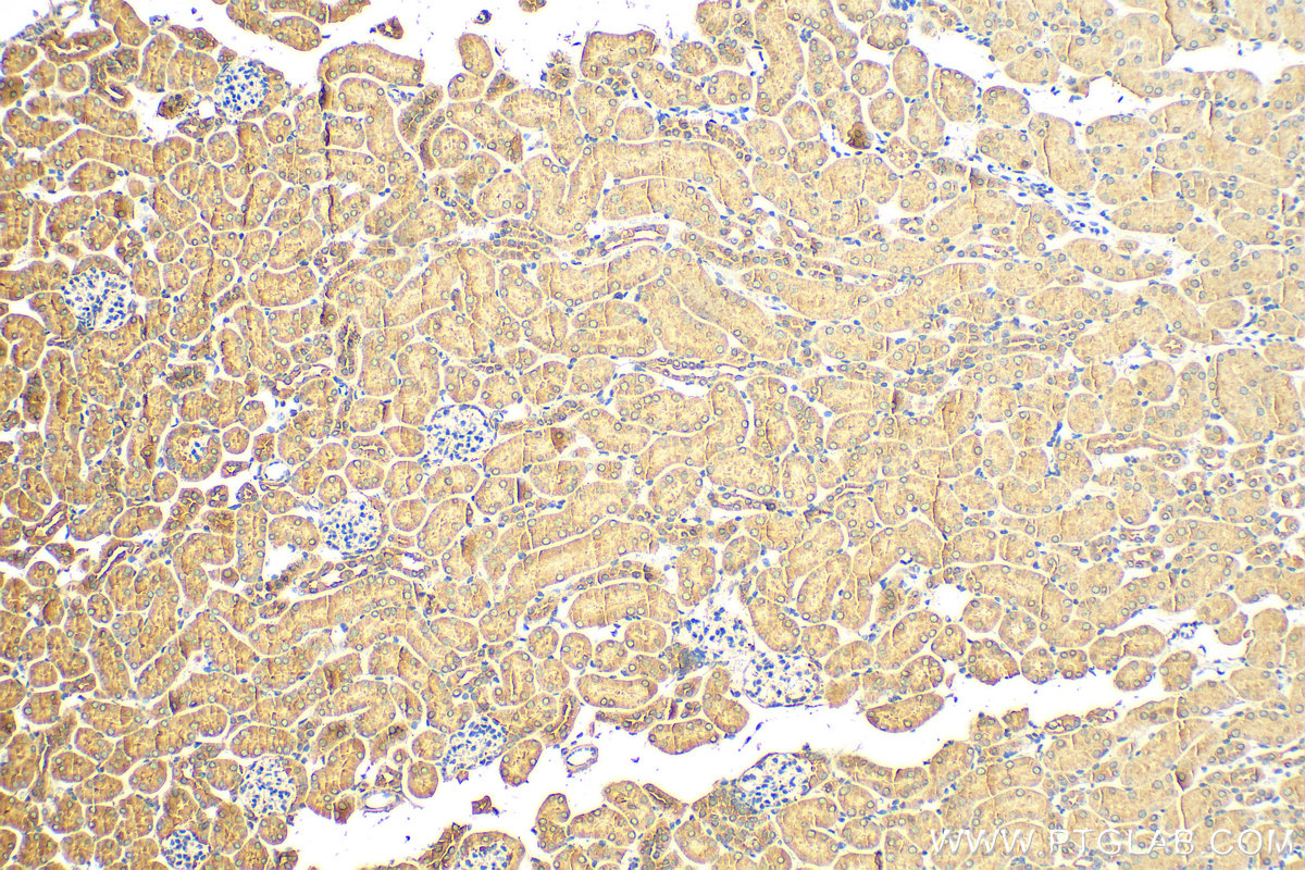 IHC staining of mouse kidney using 23226-1-AP