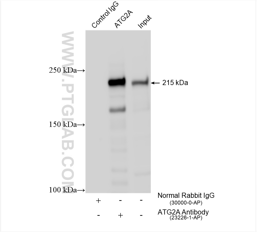 IP experiment of K-562 using 23226-1-AP