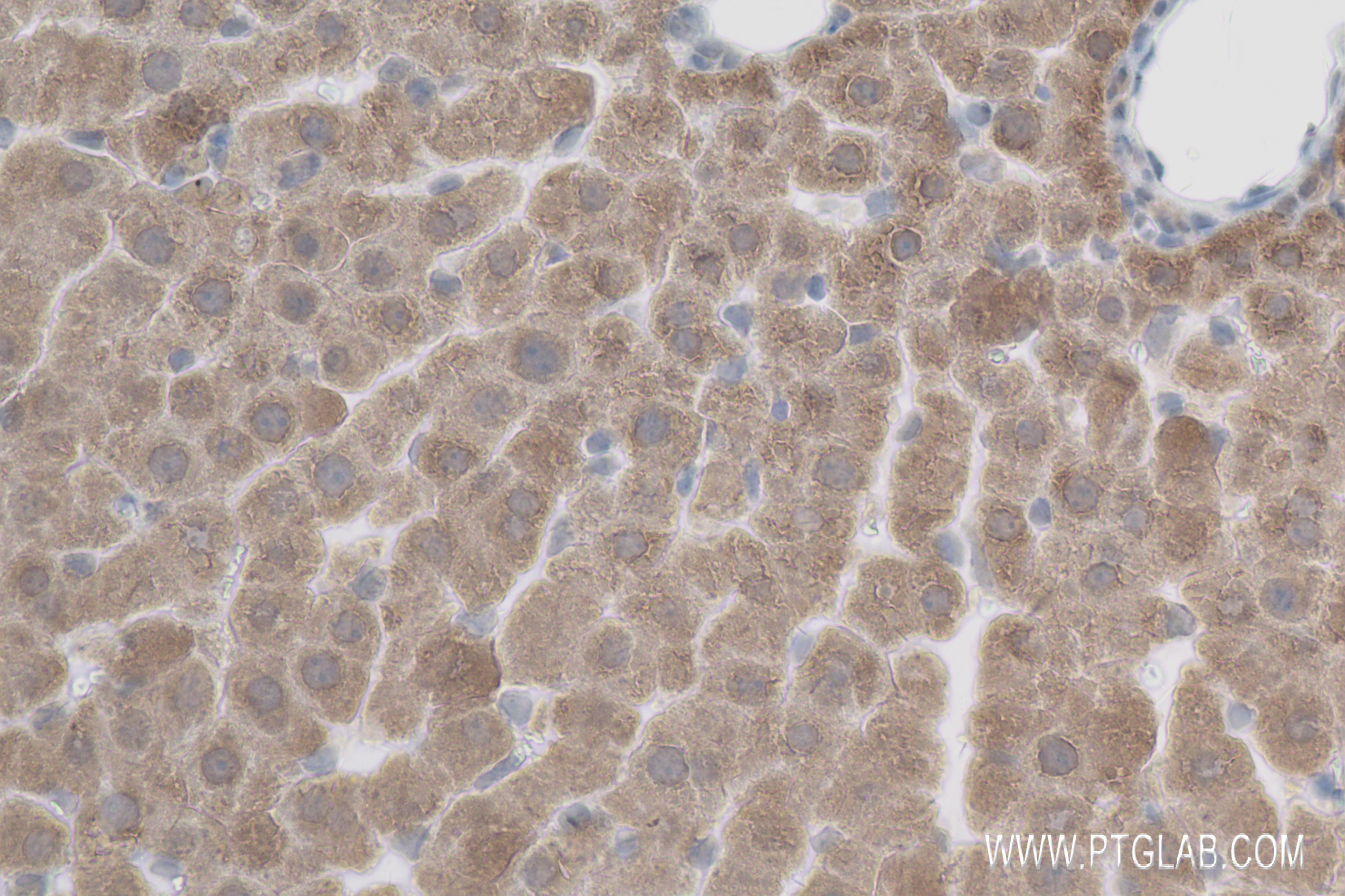 IHC staining of rat liver using 83951-4-RR (same clone as 83951-4-PBS)