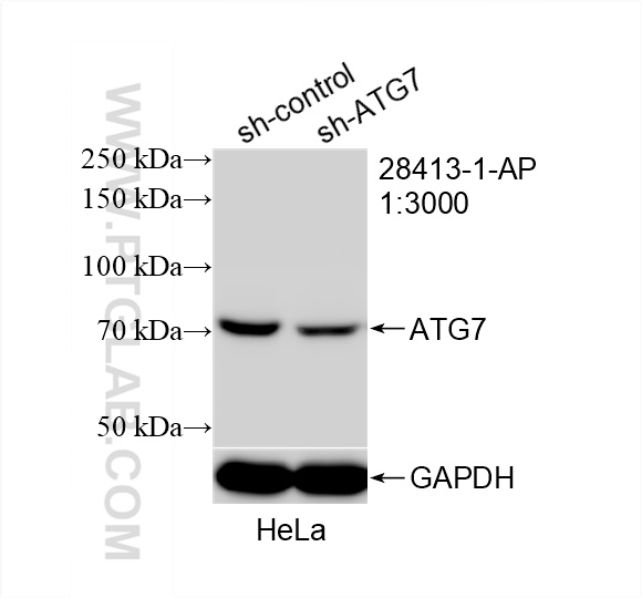 WB analysis of HeLa using 28413-1-AP