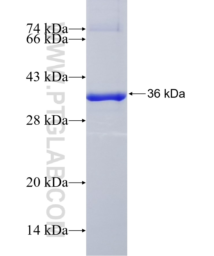 ATG7 fusion protein Ag27914 SDS-PAGE