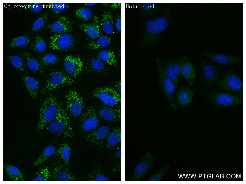 IF Staining of HepG2 using 83817-1-RR (same clone as 83817-1-PBS)