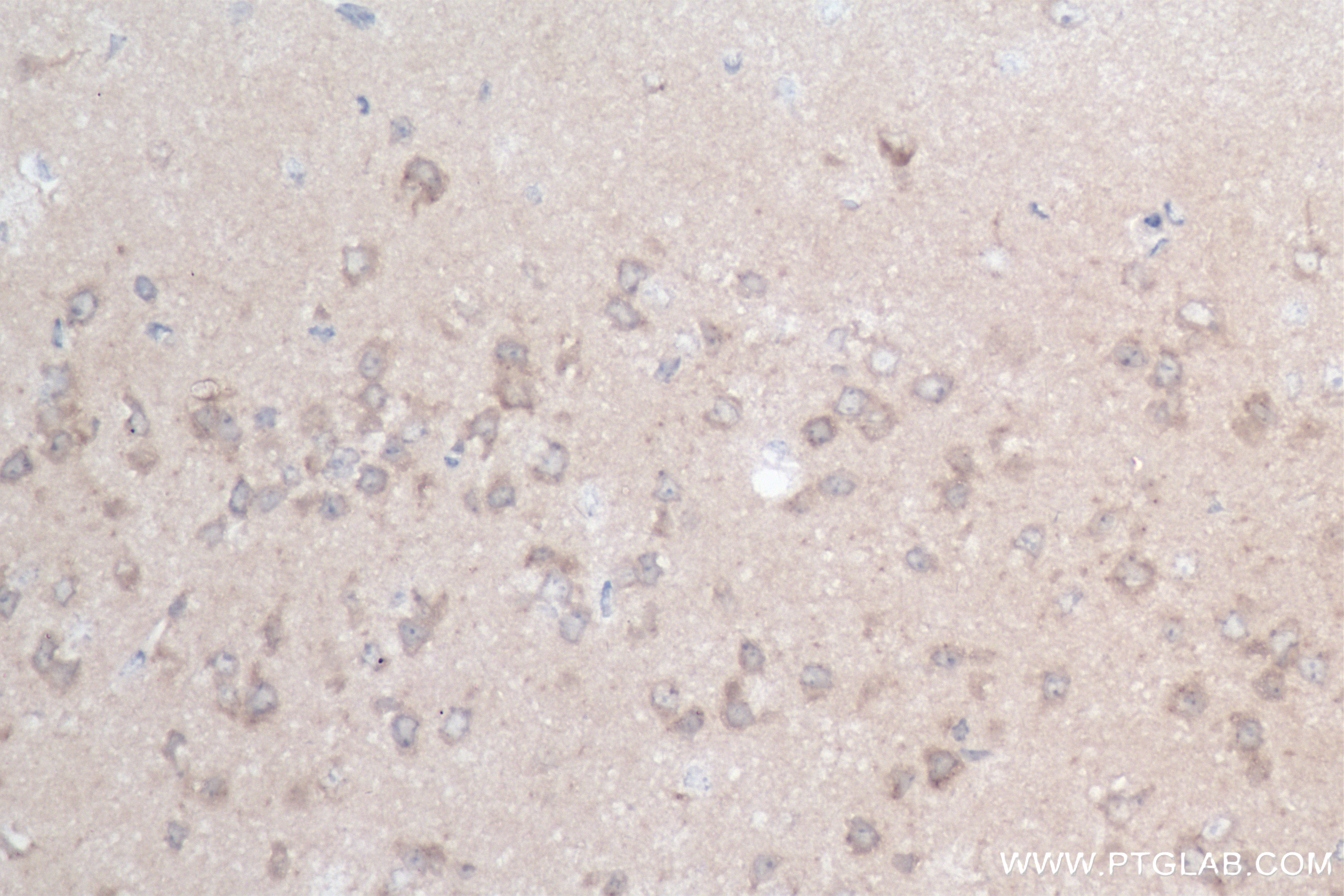 IHC staining of mouse brain using 83817-1-RR