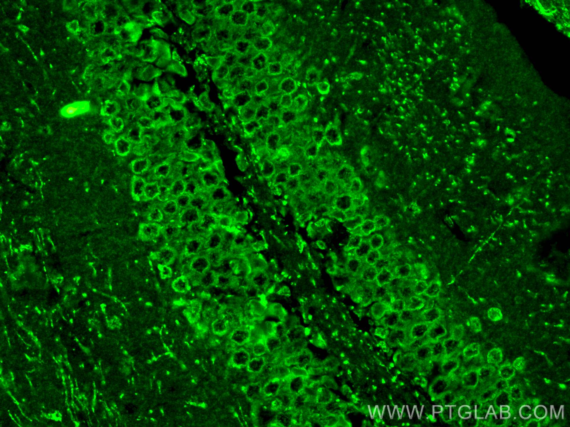 IF Staining of mouse brain using 26276-1-AP