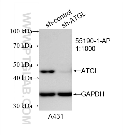 WB analysis of A431 using 55190-1-AP