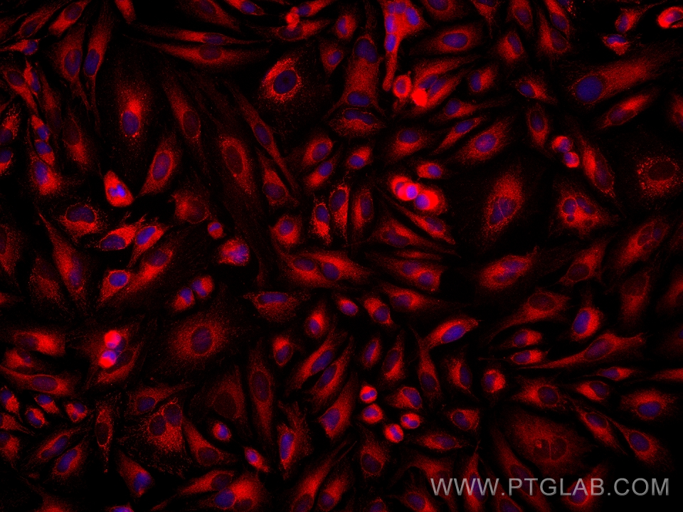 IF Staining of HeLa using 68516-1-Ig (same clone as 68516-1-PBS)