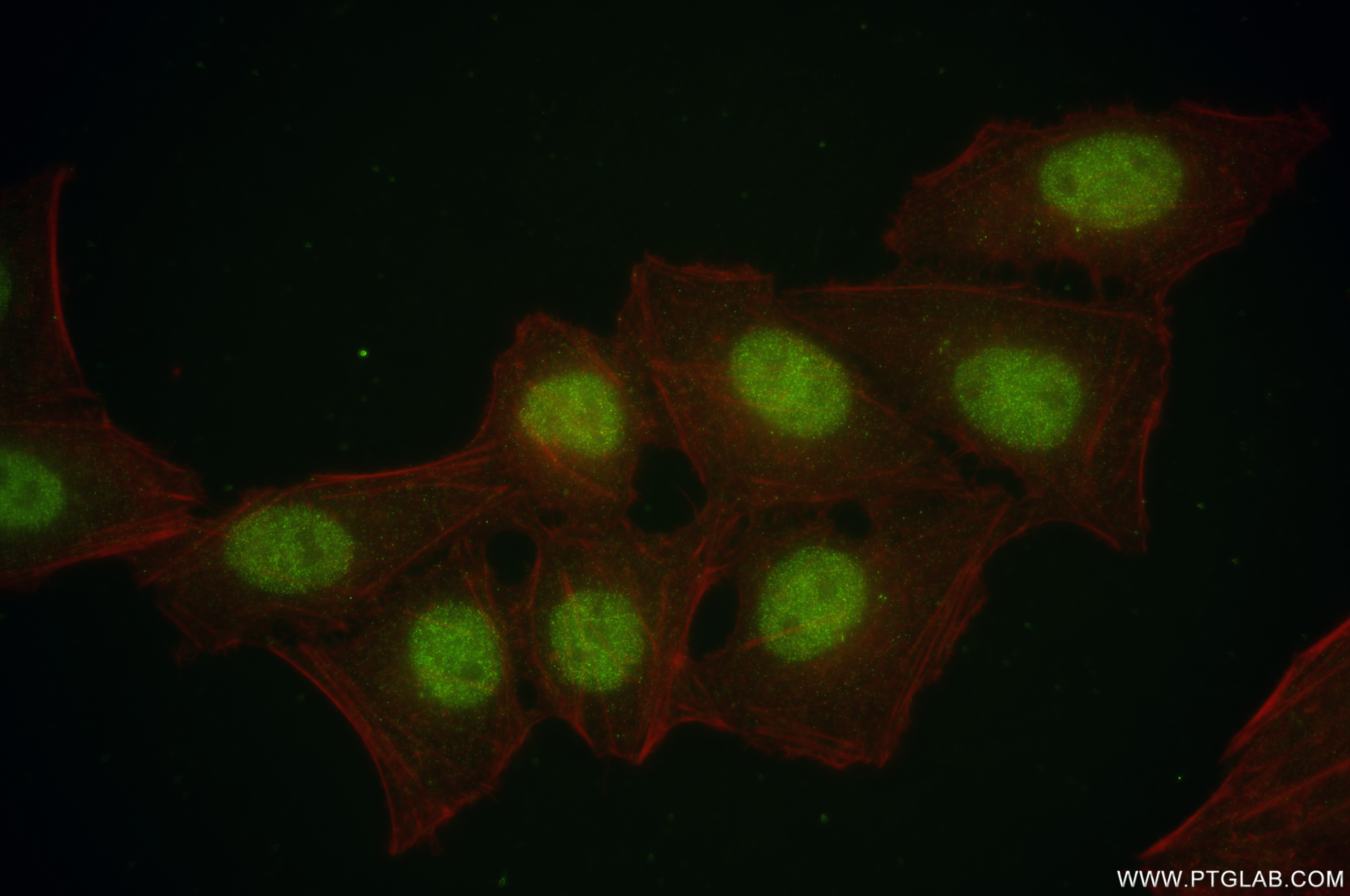 IF Staining of HepG2 using 83608-5-RR