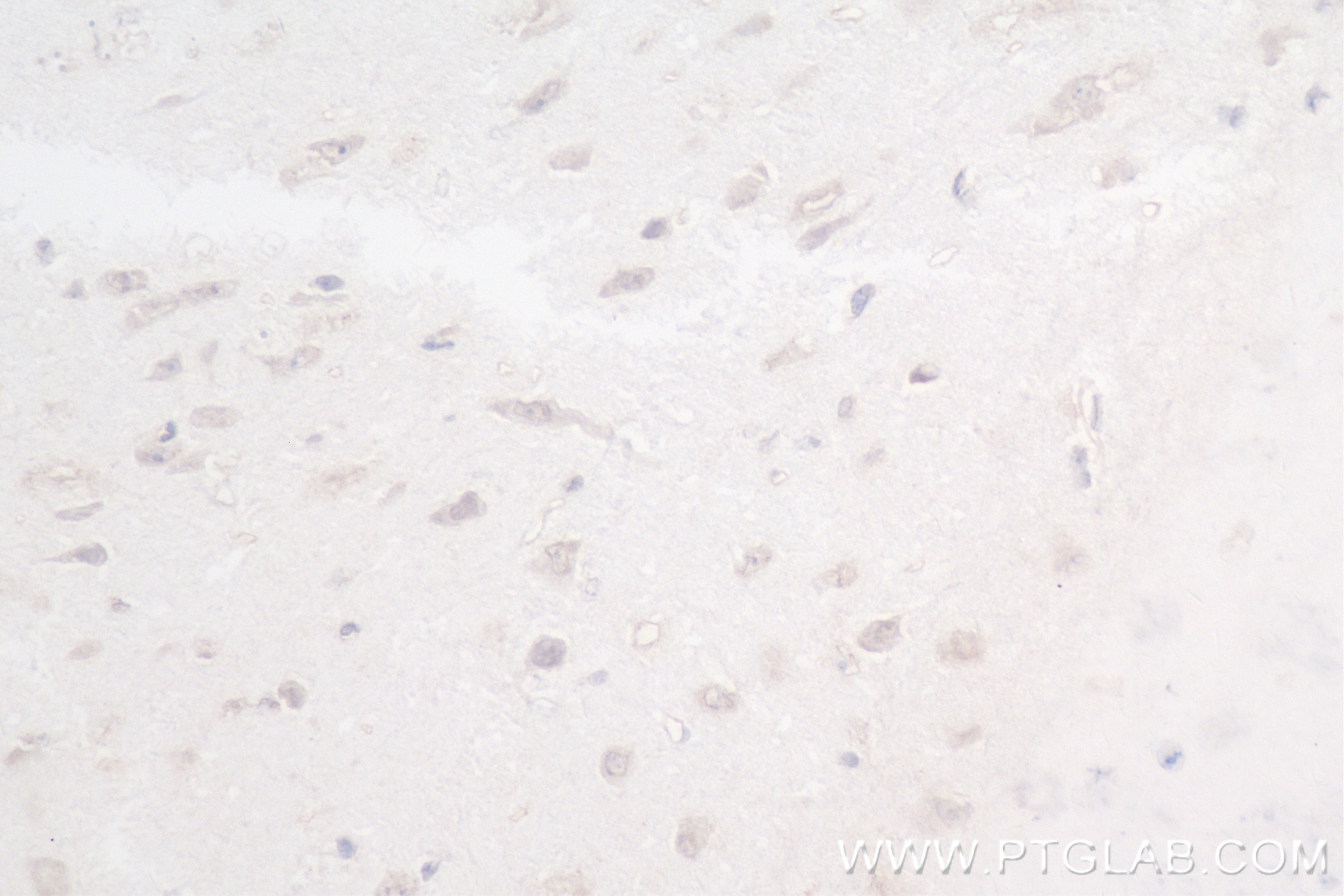 IHC staining of mouse brain using 83608-5-RR